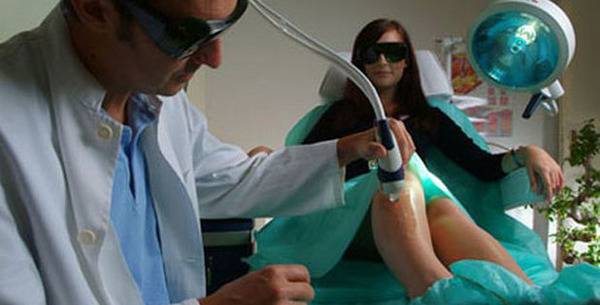 Ласерска депилација – да или не?