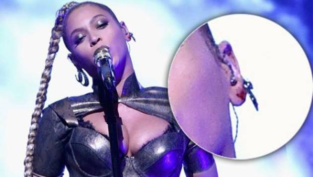 Бијонсе пушти крв на сцена