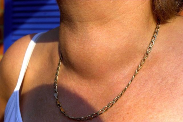 РУСКИ ЛЕК ЗА ТИРОИДНА ЖЛЕЗДА: Излекувајте ја сами со помош на две состојки кои лесно можете да ги набавите