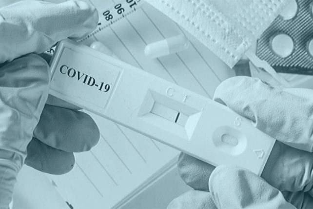 Научниците направија тест за корона врз основа на принципот на тестот за бременост